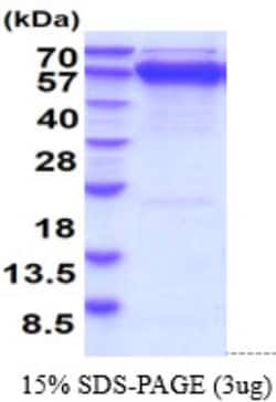 Novus Biologicals Recombinant Human GRP78/HSPA5 Protein 10 &mu;g | Buy Online | Novus Biologicals&trade; | Fisher Scientific
